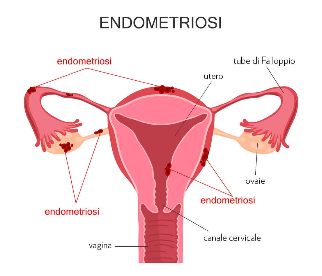 Illustrazione dell'utero