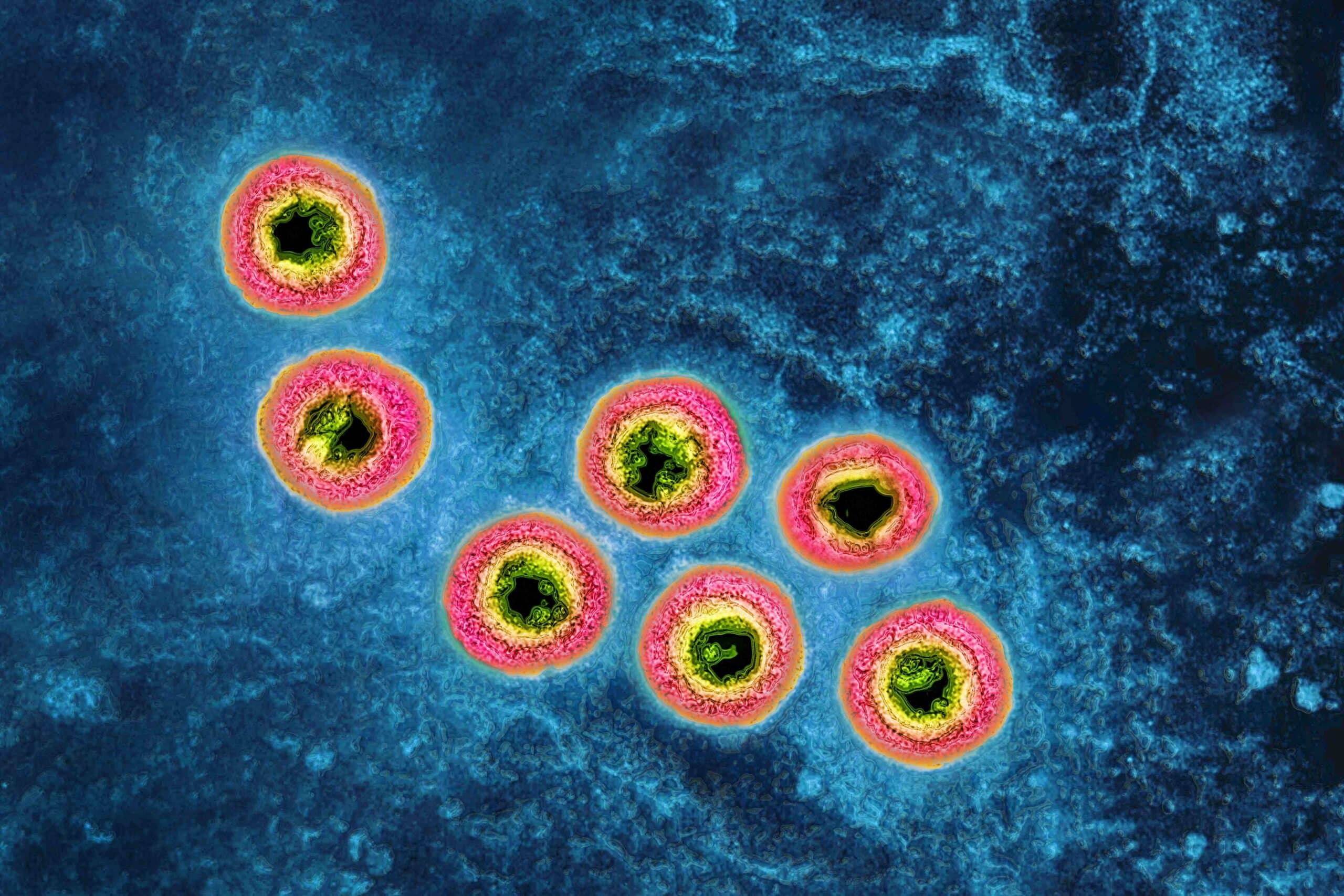 Virus dell'herpes genitale visto al microscopio