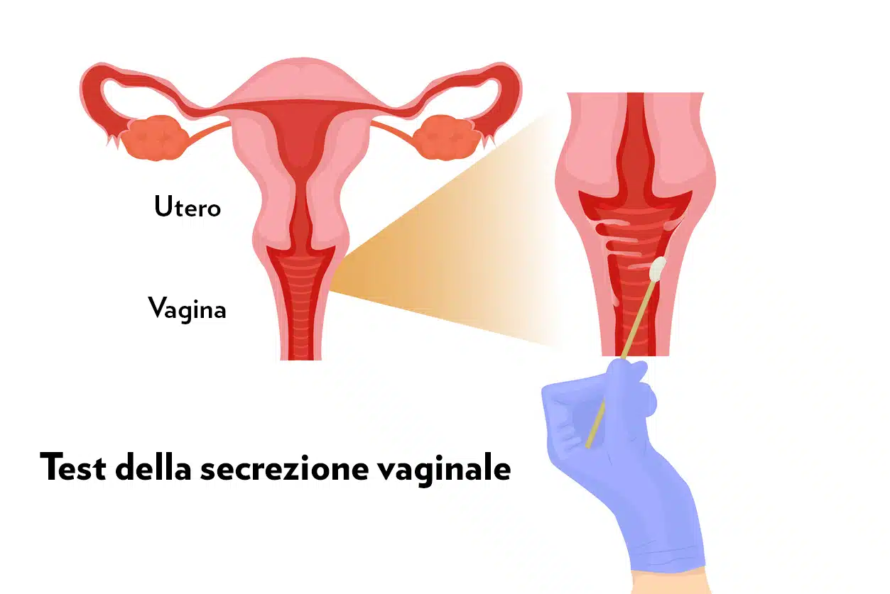 Test per il microbioma vaginale